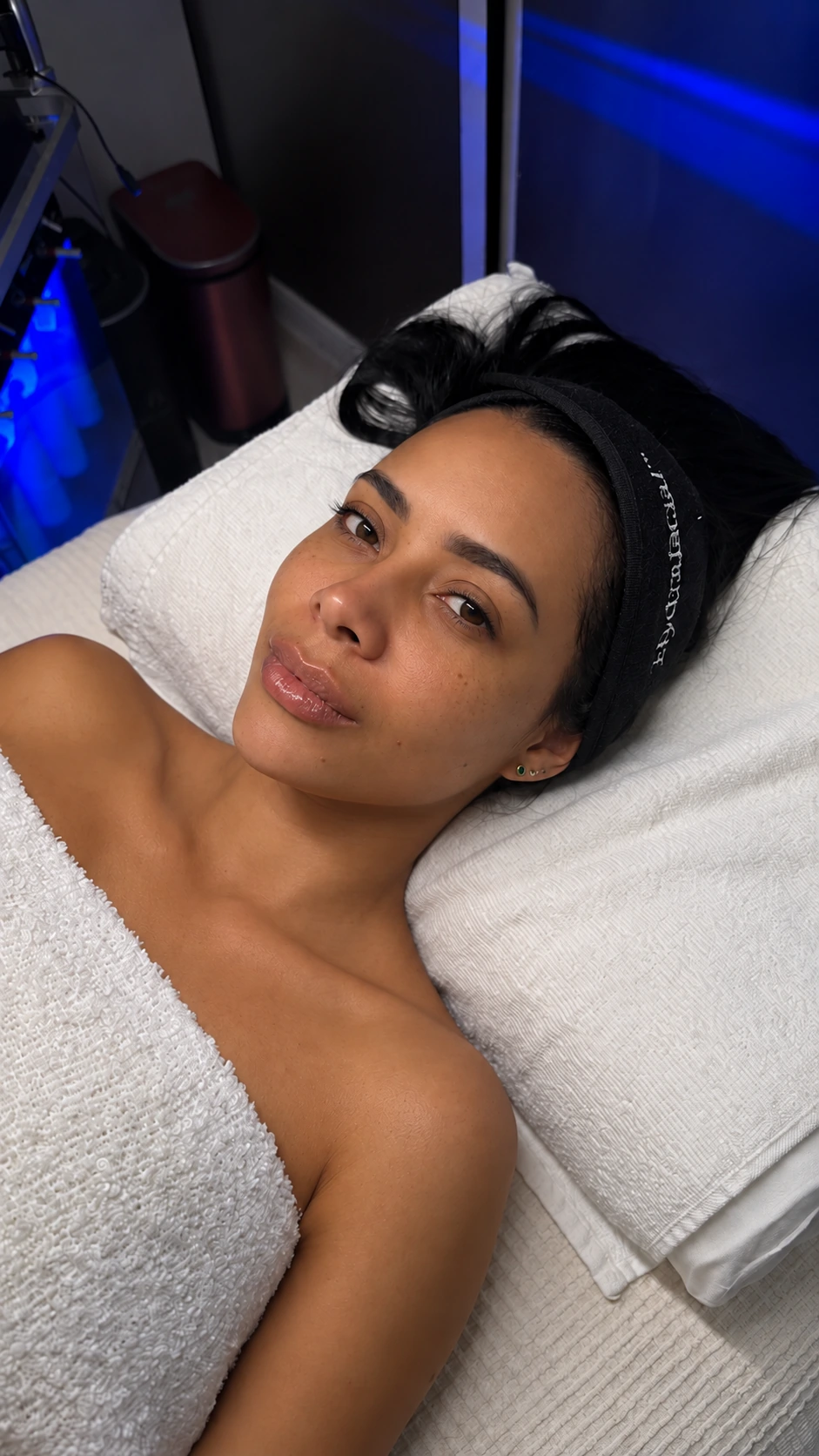 Angie: fotografía antes aportada para el comparativo Hydrafacial